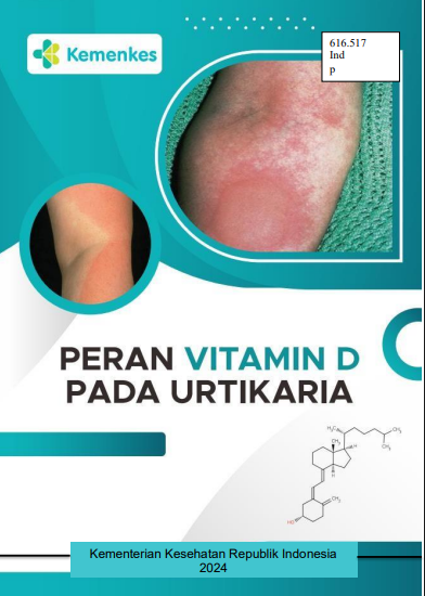 Peran Vitamin D Pada Urtikaria