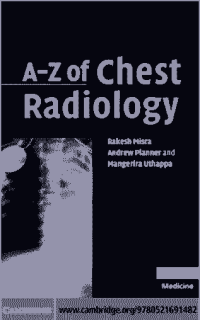 A - Z Chest Radiology