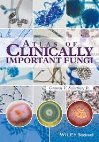 Atlas of clinically important fungi