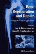 Bone regeneration and repair - Biology and clinical applications