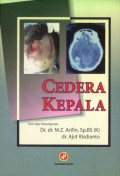 Cedera kepala ; Teori dan penanganan