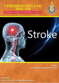 Cerebrovascular disease - Common nursing phenomena in adults - Stroke