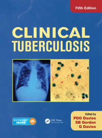 Clinical Tuberculosis. Edition 5