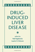 Drug-Induced liver disease