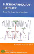 Elektrokardiografi ilustratif : Belajar EKG dengan ilustrasi sederhana