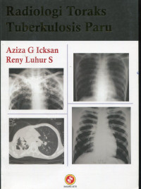 Radiologi toraks tuberkulosis paru