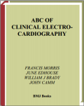 ABC Of Clinical Electrocardiography