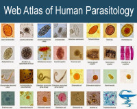 Image of Atlas of parasitology