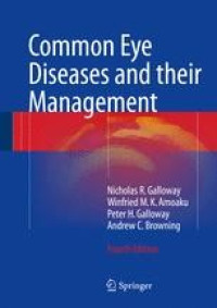 Image of Common eye disease and their management. Edition 3