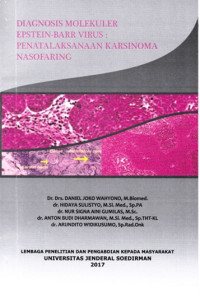 Image of Diagnosis molekuler epstein-barr virus : Penatalaksanaan karsinoma nasofaring