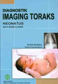 Image of Diagnostik imaging toraks : Neonatus bayi baru lahir