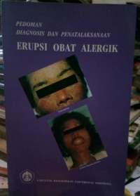 Image of Pedoman diagnosis dan penatalaksanaan ; erupsi obat alergik
