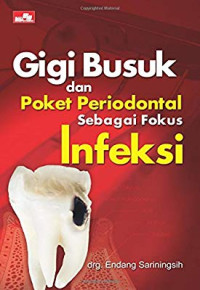 Image of Gigi busuk dan poket periodontal sebagai fokus infeksi