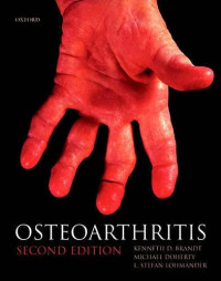Image of Osteoarthritis