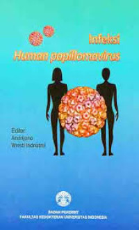 Image of Infeksi human papillomavirus