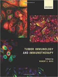 Image of Tumor immunology and immunotherapy