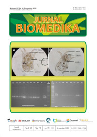 Image of Jurnal Biomedika - Vol 13 No 2 (2020)